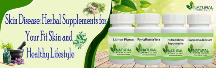 Skin supplement acne bounty elasticity vitamins zinc complexion dietary hyaluronic softgels vitaminwalls